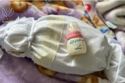 3 أطفال يفارقون الحياة بسبب تدهور الوضع الغذائي