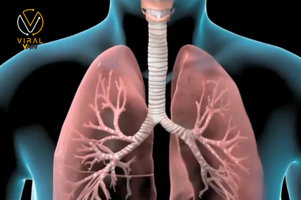 كيفية التعامل مع التهاب الشعب الهوائية الحاد