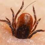 تأثيرات حشرة القراد على الصحة