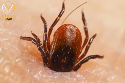 تأثيرات حشرة القراد على الصحة