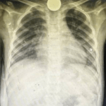 طبيب عماني يروي ما يأكله الأطفال في غزة بسبب الجوع