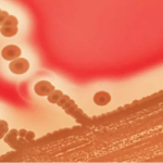 انتشار وباء مميت في اليابان