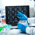 اكتشاف علمي جديد يمهد الطريق لعلاج الشلل