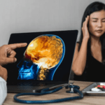 التهاب الدماغ وآثاره على العضلات