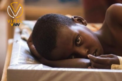 تفشي الكوليرا يتسبب في آلاف الإصابات حول العالم