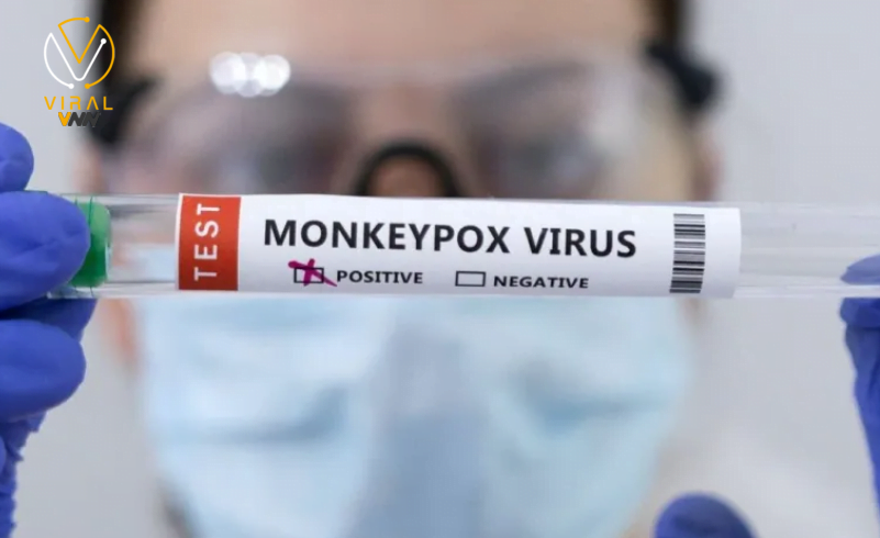 نقص لقاح جدري القرود في إفريقيا