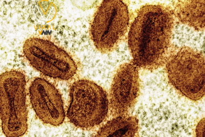 كندا تسجل أول حالة مصابة بسلالة جديدة من جدري القردة