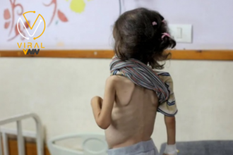 أونروا تحذر من خطورة سوء التغذية على الأطفال في غزة