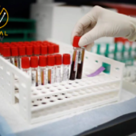 تلوث الهواء يعزز احتمالية حدوث جلطات الدم