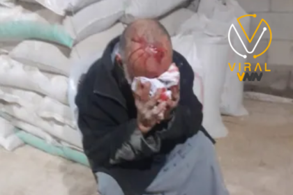 مسن يتعرض للإصابة جراء اعتداء من مستوطنين في جنوب الخليل