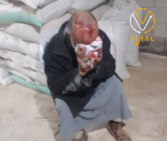 مسن يتعرض للإصابة جراء اعتداء من مستوطنين في جنوب الخليل