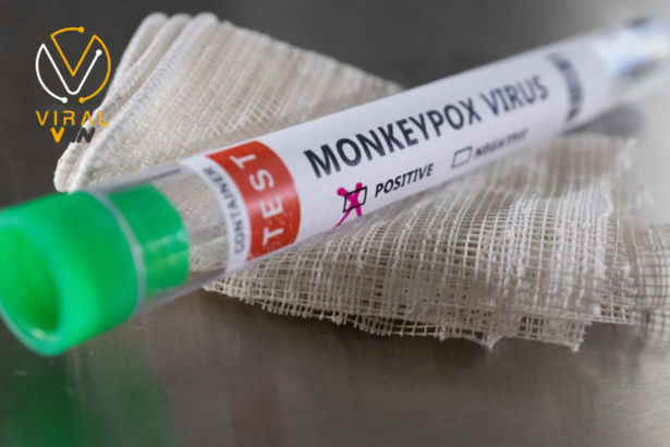 اكتشاف سلالة متحورة فرعية لجدري القردة في الصين