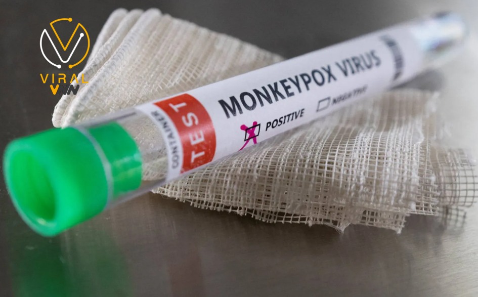 اكتشاف سلالة متحورة فرعية لجدري القردة في الصين