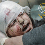 العدوان على غزة يتسبب في فقدان البصر لـ1500 مواطن