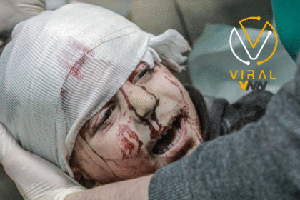 العدوان على غزة يتسبب في فقدان البصر لـ1500 مواطن